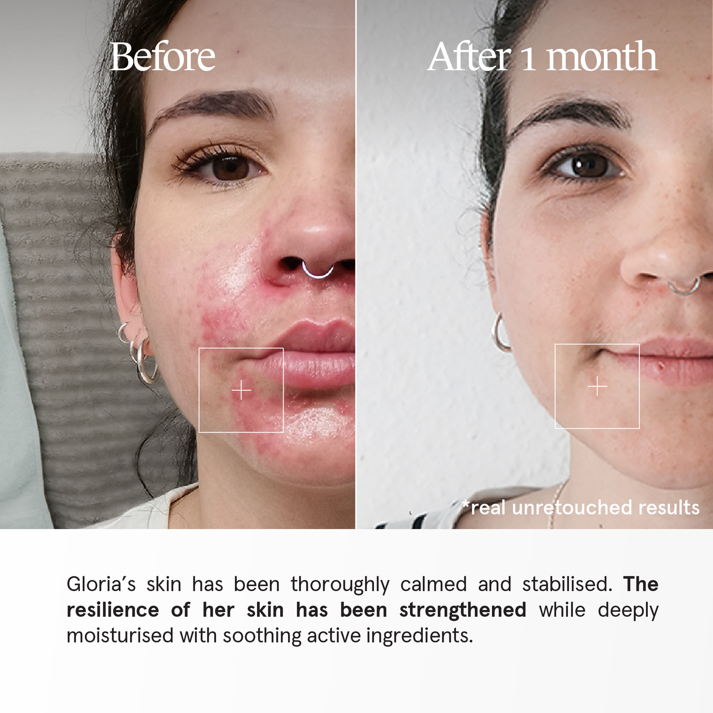 Filabé of Switzerland | BALANCED SKIN | Skincare for Sensitive Skin & Reduced Resistance | All Ages