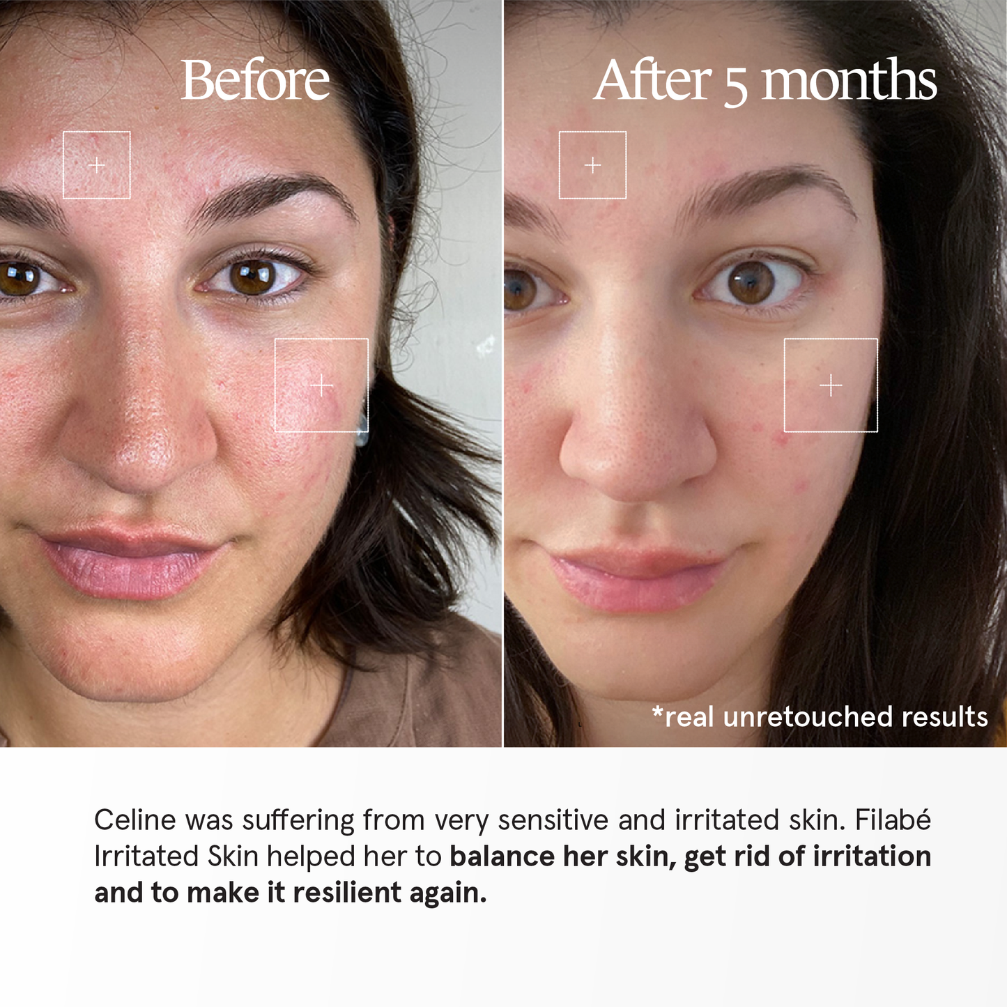 Filabé of Switzerland | IRRITATED SKIN | Skincare for Sensitive Skin, Dryness, Irritations | All Age