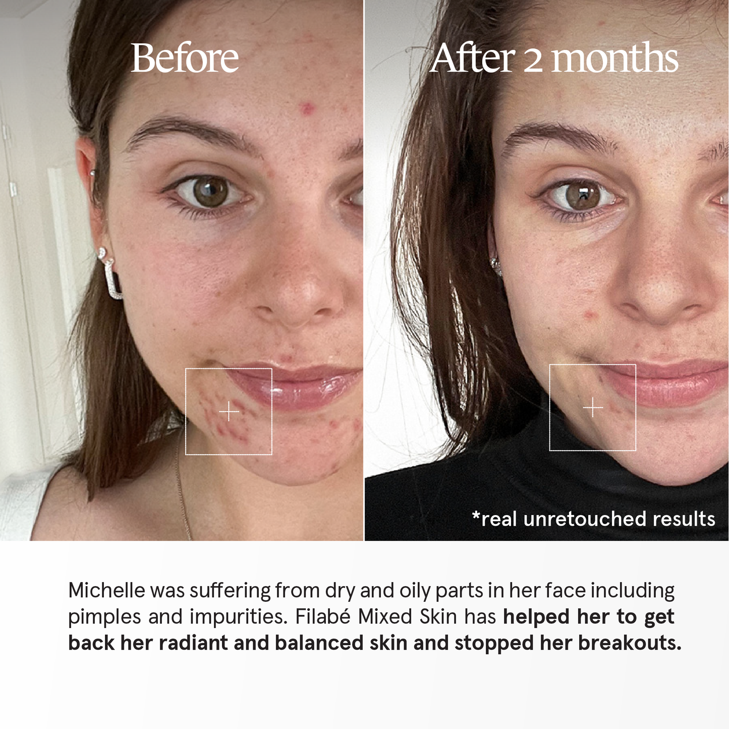 Filabé of Switzerland | MIXED SKIN | Skincare for Combination Skin, Oily, Dry Areas, | All Ages